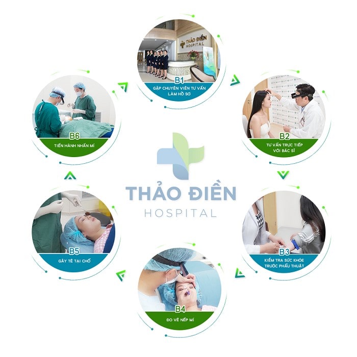 Nâng mũi bọc sụn