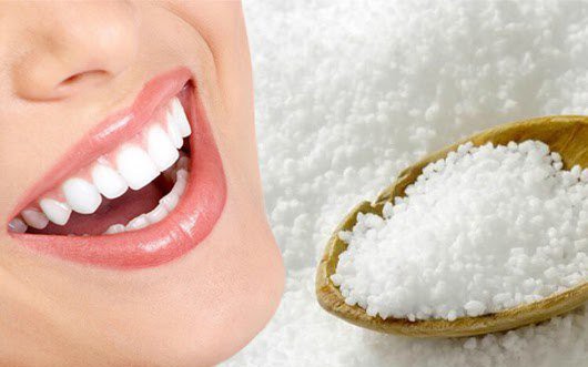 Rủi ro khi lạm dụng miếng dán trắng răng